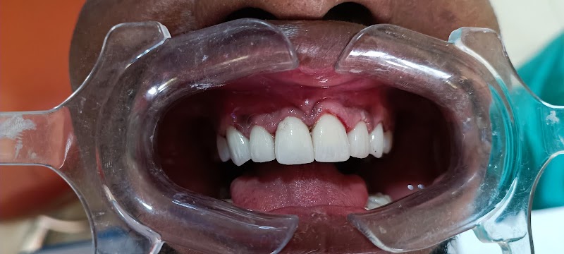 AZLasHpQGV4McD469jV_9vMZHabbkbQgYJh83pobD_HwOY4XOXKnJBiBBZznnbP6tMJOMVRsobgpdm4iwvdSWrKiHiVDDQc8MB4lS5CgMUw6lB0Y5R4wriBGMu6gcZxxbkjtuQmd87uYQXxIliSrqM8AhmKV4DeEC36t_tcVNI_KBgIL18s1bAJ3_C0FNXl965HXctJSs5i3Z7B6bJG_uW-WwD_lRcASw_O6rDlDGajj4PAWp9T_8UqLmYCBKjYk4vITNFGmdKhMPMTAbEL0Gr5hMPw3228gR87zjVeNRF_wFOe16g_0