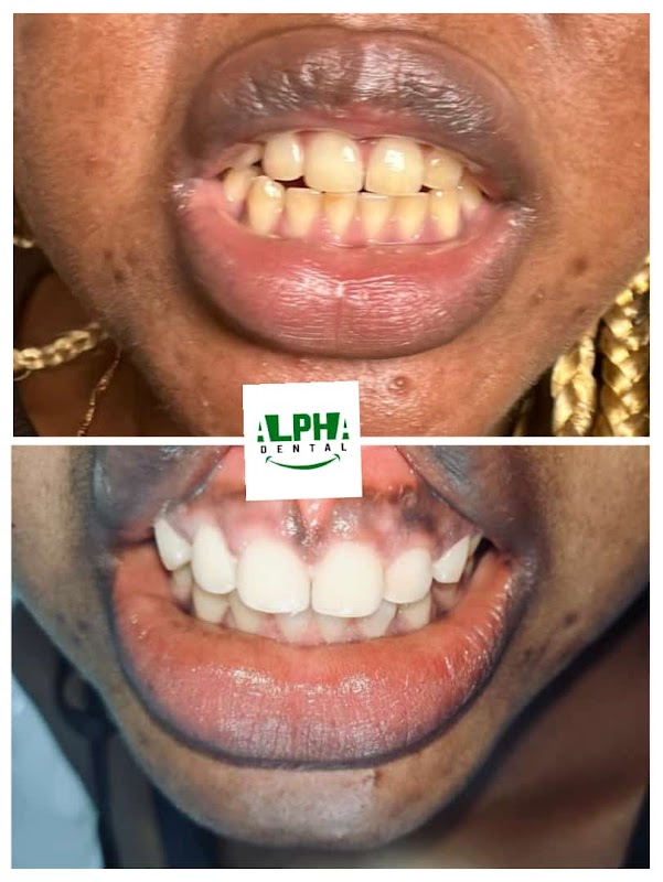 ATCDNfUQkB49boQo4fgI6xiFfzQyDomBXQZao-AmWXkfAILSHLEleq8exjGpRiE9bleDWqG7rGYjfQQ-o0ZP9qnHFYa9vNBewRsyOw6tMYchkQRJvMuOYThtMoOu8Q25G0KaiHCVbm1wL8bSKOdUNpUObypysmxjWYiLi68E7DWTOyjlY450bJCOBLFM_5bGJihtxmNOldigWCw1EpuPuDUCC7PH5y8s-aScaKA7o2ocPpNQVDSmVZa-4ibbFTmmZtHVFDAe2ruhhrCNdT-GUnmn-sqS8ioY35utfxXpPoWGsYDO2A_4