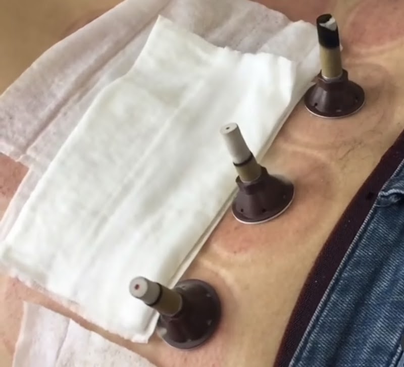 ATCDNfWG3ROB0eJrVCwk-mqTCcZhM8VjaCivcIyCoAcFVdDSDTanYENh8RXBtKlZMk37KixSilsXJ-9NXBvFOybPCVOh9Ws-37sUM6eR2u9vcEBkdEwIYYAaNU55nMmMQ-0TCIFd3y89QfGKws1olQVSyfRJF6V364aaly3amlhJJV3s7kFgFHQX1VRm_Na91zD236sE8-LpY4uESZU3l5CXwouEOCNh-I7bZNnH3oU0rHyNaFhqbNpGzmKzcAmPIAN36A4vCdsTCihbKB0TTgwOyYSf3VJn6YksvbRYcsCIRjbhfifYeNj5q82YOWU7yd5UarbUqsVnasF0xflfoY3xXpqSAJdNm4Cjfq1XxHO6Vq9q825xlPi7sCkSG8tlFtS395giXYd7GULJl1qrxi0l9bM-dx7P1RubONivmdkH60v6XVb5_3