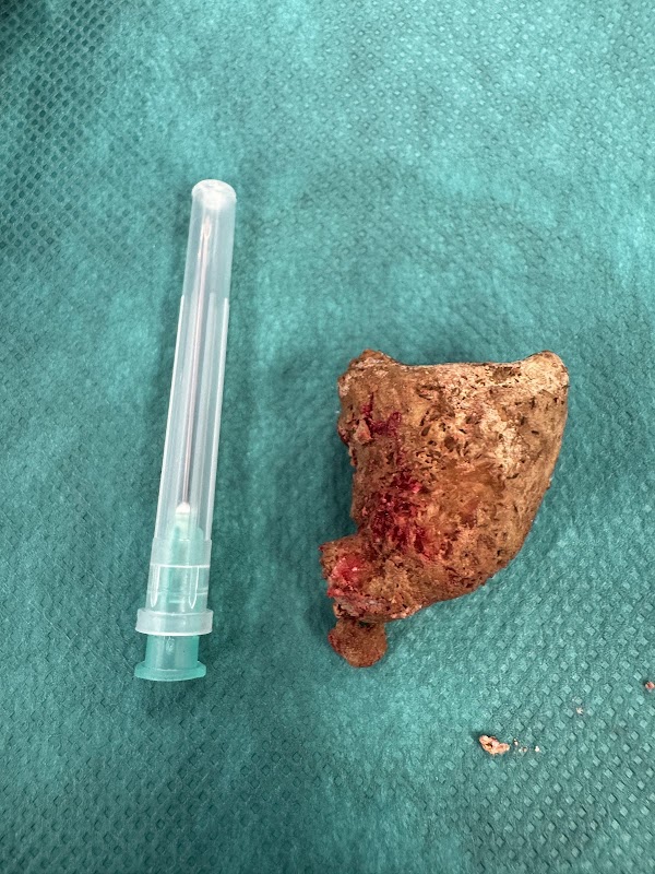 AU_ZVEFVf6VzKEwq7YOX3S4SJI1e2JcUkNmcN9OJTSqjrYv3_33KNMlqFUuR5HZ0Es3WT27VDIkc9NittXtQolJVtDfY0NFsr7wzyzj_EfVbdWb72B2Dg3woLc5GT8KVTrFk1sU2uejdCNabBqVDyr8nMdgrwvFjjqAZT8GvYc8n_5t4rmfj9eViyLAuBVfCWWewbWqmp8hfFD4AO0trrAV6-1alzeHUwjpUDhO9BsND9LANYU37Ao-X67kFnko2K_hvZqS-ogIlvtMEAUQGKUXPyvDw20lcqnUPNiMQNMn9YvaGwQ_0