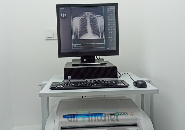 ATCDNfUrElJian6XZDDDvkGQNFCjAWne3lLqMPfGVmTea2uOT-XB0y-wyLtWcykgUbCzdiQuXk4ivypLSFOXrMHdLYij3R5A5t1XEoAeM25oj1lq4Tmnh-qROOEQ1Mw6LWCHWkxirzIezCnAcYZHM3pQJKZZOvQ6SkF_SjlwlONXbAKkud9LlL_zSQRJRzAk-FaM2mB2jo4PshS9HQiPMLaSWqRF4p6bi-hb8Wo9jvBro7JTyWJYoHbloC8L434PRquewMVbM2dY_vSxr-C5P6vRgyxu04NNT00iWrUoXjEBt6RcGw_3