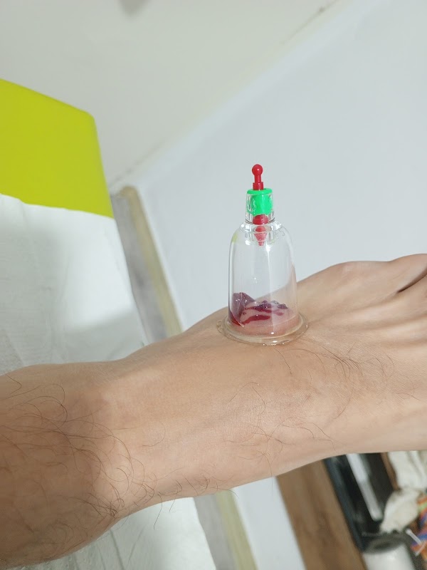 AU_ZVEEQ71pUn7i7rYTxleZpjhhyk3pE8Km37Qhozfo1ArXcgdHVzmKU9ae8VRqhgRJYoG9gL1hqDOrN2rcFDgfr-wt49k9aMsUUjYspPVqnsgEFv1tMc-xSl681MfEbNlEIUIJC31129AN14VGb9dGIMAhtc9YWDcyzXeKHp3HyevPC-qqYXA5hXH3BZp-NnECi8xudtygapQ9-iBdhYzgIgqyzCcPUFDhzGy9giJVKQuCsS19VJcJkntiMR6a0x1Mi1NGPC--uOuM3Rupo4WPYLCapshnBAWWq0-5dRbYXzEuJSA_1