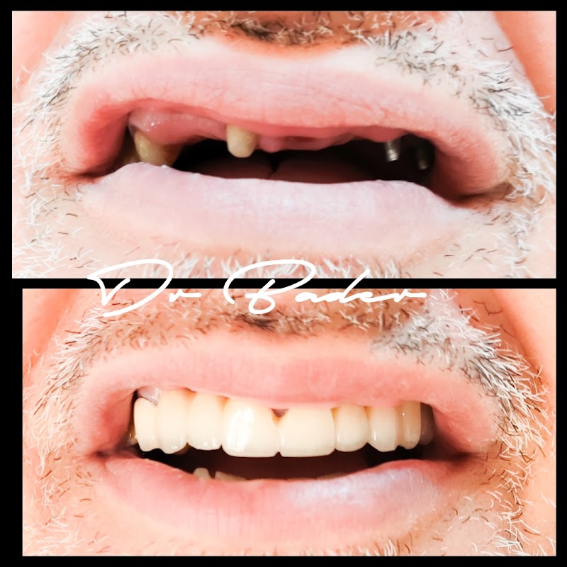 ATCDNfVUEIXFwSyvsj_EL0K_TQhDxBjxrHSaIGZyofMOGNiFc8bt8AavtLmzNrwHaWMPuACH6_sfzMArnDoR48uAwCyMUc5INsh31vV5mL81pXRbGqxARUlqG4d2PKNw-aqPTYvpDi8si_X-SPbhiQFx_OsFcO2VeBONvWildJchqCQp3DdsjFAZaokGhd1zs1_ZzgZ-OwtCNZSR7Fal6gaYn1tjIlmnMKizub_haFQiXxnt-zR-Cj_qkCN06RPBrWIEwR3wcqbXncYTaZGORtIz9vtdhuyYVxRkyMGX96Av5Lk5WQ_1