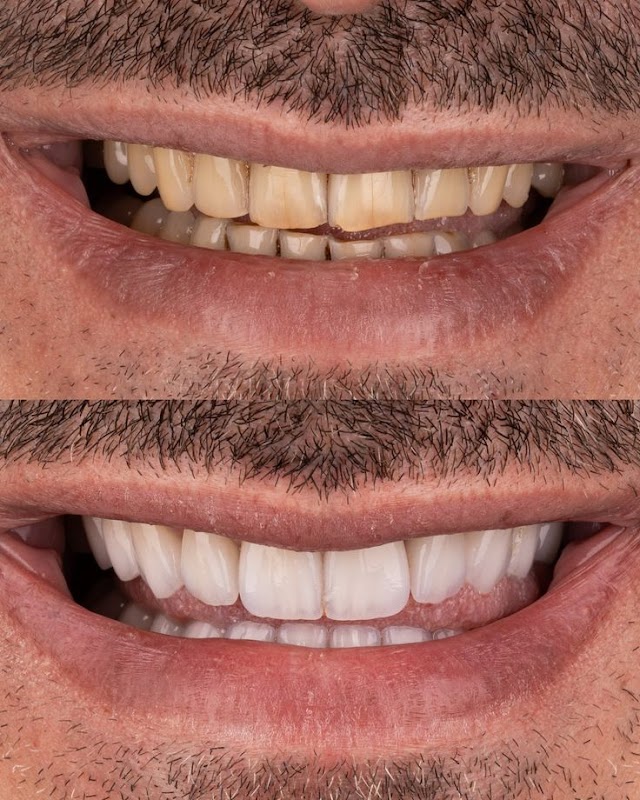 ATCDNfXYK_NMACt8LyyoX1cY08XHiG0_0NoAjTkHgwfxj73J5Y7C0klNVfwoD7r9B3PErRKSPx6Jyk1XyN9UB8dLMnyK6LgtbAb_qkqKV9nMTTIDAw4UygcLWtH3zwM2OFuNtfYf5idIvP5lmHHZ2mfqMwgL0tfpt8-ULOihjyMNklcEX_cussaAFsYY5QjQrbefhfsDCAeke5_aDSZRiEslctillbSJMom2pVXaRYAlCH4BLrME0j-1T2mMh6wpVfUIjMV7pbBC7js-yHeHqMYITpEjyLstNowLTYZu1wmDUGWKCw_1