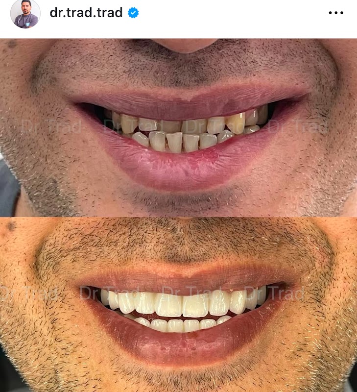 AZLasHrHg65tOruwbg8WbJaWiEMTYAKvamS9NieLitLEaZAgez9AUUYBntBO2DHIl6CNXoDf-BTRTML6WvpW0z6j6FHqxKahBOioEs27mnud-wIF6jY5Y2JEZLymxdJ9mQCn6tP9VeUHCGhe_kq05xU-lxrOcdss_MI-CDKLRrc6uns3lS17yoIBmsq_ahZA_nsAMMhI2DFfXTe6WPT53EJ1O8rLRuDlMIV-vgXntMSm3gzs2tbzVCiU04ynhbmfq448Hd3UG7brsV_sojZHTbht-L0koinWir4JTKSUKspTi2tG1Q_1