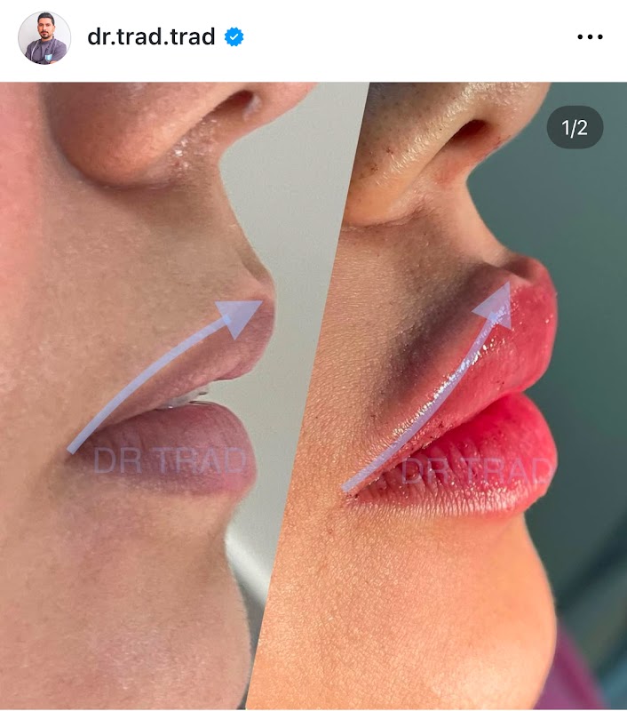 AZLasHqfmKSmUIUMs6V7BGCvzEEalnKE2elEl82qdp6Mw30B-_vGOGOWTLc6AaIYlaIQ23aISJJbvbHblWmbR5Y3Fr5M1lzf3b62gqS0u351XHpvdjiOXEfX2aeHB_XI9rJLTE7RxCa2lSjkPVWZlI6L5XWeLNSxo7rNG1rUn1C5rAlJxHazUriSkN2tQWHJ6PJYd2Q_2FUkINhbQ2j0E4ooxz98PcP1MO2wpTAXYhARQjhUmuM-OqK51QRbPAwO22U36_-Cdg9eKS_mFXuyeWKzDG_XMZS-DP5A-6jcTtFp_CqqQw_3