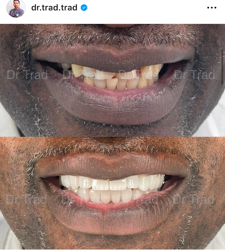 AZLasHqxESoxz-uwsRzrF0X8z6KFoMoFoO12pS8QwwuC7981iANNvkZn3a_1jLr6irzHUZ-SciE2w50Mc_inWYOKw5U6p3z1tWK9lEkKZy3DuaJjB8XTMZxzINX2CS3VCkZLpqLxU_tWPr5ai6b6Gp9NzShy2ALXR2bsMWc4qF4cTLpZWL3IY9JAGLE8-hlbDXa_0oj-uUk8ZA-Z4griR9X6JB-ce0mkGcenKyTMOi9zxE-lJRH7RVADp7g_9E90mssRaJkNDcETWwbpiY4sdHPHrFmjKFyjBCz4lbQdjHmjV80OvA_2