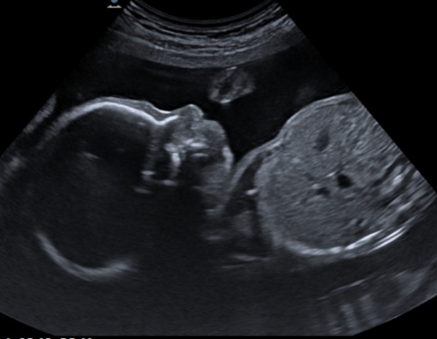 ATCDNfUoMQ61IOOdaHWIS9gF8VsX915UpvXKPXZk2zBcuBKCGV0aRPsH9z8Xi2lLqDNvEACDNHtpx3kkZdG0UJBy5nsuj5pjgP3THRv9Z-HJUOJBOiWr0_6QGUcop-dQTNk6DeeAT0taHnZm8s-HbqSJuECsA_mJXFRYNz4MzPS4DDG_IaosZfN1v6OoNt299ZIfiJ68VfJOfpV8-FkFUVd7JcaP5KIpjK6AVfO3WK4VElOQGZMbIUQwxkdOV7Ux2EnFexeC8frqbfQwWDeQY9Dzpk9AwVMyUWSDwPYhAo0jebfLLw_2