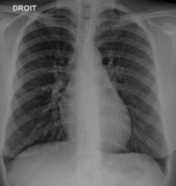 ATCDNfWD1Y2qM2d3Yc7O2C3pjk-T5sx-tIW-eoP-eKBDllba808viF-8BFpz3eRHdHL8neVXgNki4XXn4w2-PpptoTRfw-rhl3fwGc4BiowfvXDPQcshXo4oknZThmqDNXnk2QDb8FCOoccozda9YwfcVU1Zj-1zqgg_dJlA2l34gigElE0-E-VWjaXuH-p06epnEz05rPQNSFARsbo6zAkAZUEiSgmpGpjO1WE5VuNTHuBnGcfyfvVzKEWmm5-UVyAKkHPO0uZqSnsSy9GGB1SnTPuMs410rCmhTXeCv5ofnuj4lA_3