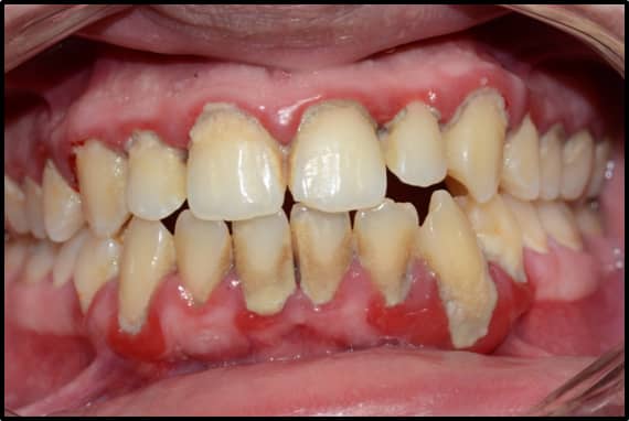 ATCDNfXMk0KGia83hYbft-LDN1yc74ijTbeyQG4AMwXDrKoEruWb0YSfPo9c3UWXFFU4epkb6MIBvL_yqGPuwglkcaVL6WbOyNTQKMvOpGg69_epPILwqRyk7YOkTmgNAq9ko6fnPCGUYS3wb1Wu3Ir5zuVyZmjtpoEKRMc9jNcz2PU93FXufTftP6UbgGzK13PJ1dNPRoThYx0NhvyvCl0LCuZ4mDK0Ki0uVgZbeqhUdjDZekLLvkCzfdi1aTRmqTfN54MJ1d2-EVy2sI79REhDVrdKw1D_FkfQNnyYGD1hNd6V6X5u2vpQoMFxCgBWq6kl7US8moP7cucz6DMEBnPgasmpSD0akAPGQR3FdhGcg61mAuVECdA8nPakAtATdtw3Tqj-5mY1vDmsN-FFGyW1h_g41a3lQqtaGYx6XMR67-8_3