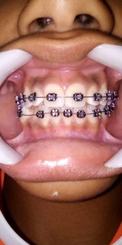 ATCDNfU9SpNiefkeLvqUorSp5HvS-bqFi_ve7qbm4EDg9N5C7Fm6S54G-X2vRdxrNvvTnNn3kfQnEBPEHN9ANCmRI7uLDeXvLQaTIvGUp0h8K0ANpvCcYGrOnss8LfLxs1qJmhEq5EqaLAgEzt7CrpOAclS4IuSAMUFjVNkqTLVIQDh470PRk_2_O9J7fBRpAKFlU_1RwDqhsgf--huX9vz766OWh9ke2Nw2cGgegX0kOKQvLYDnfogg9CZA90ilTmIh18yRmIq5MuDAVnMfVy6AXAh0HvYLLo07ZdNdTs44w7JVkg_1