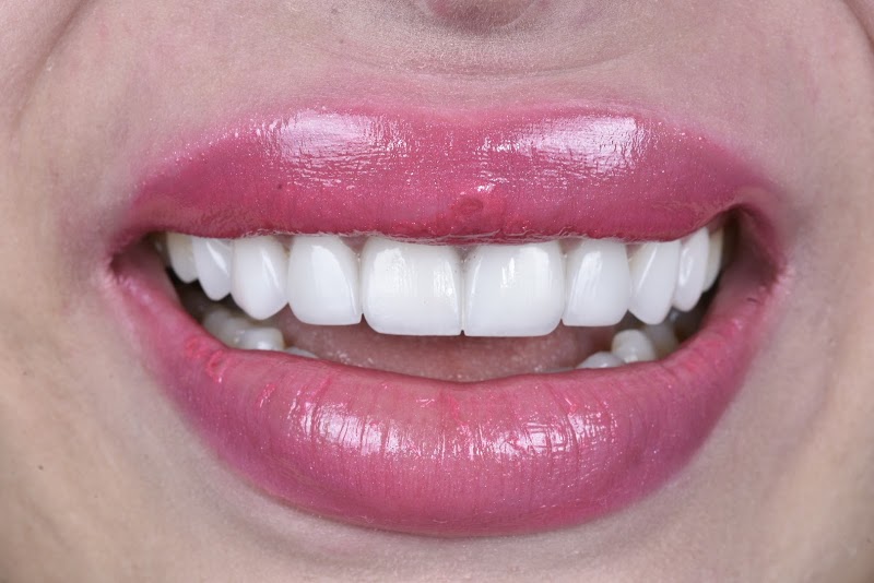 ATCDNfWerph2JF20Z1q4DGQ2TlrJejB_oU9nFehEZGnLFQMHSTkgwMvHwp2qom0lz9tHYTRrYmBnr_JDe3jNowuaSLxcssuX9yeuZbo8niTRLTaCzOZi4uKwGO3-O6BqUfJ9iDpNekoua5VOoBa9VYX6HJaA7kKSC76FWSNoo3X2ZAHkhB6dLwu7GNSgwy4Pls_3M5zRHXFov2LO1JRT3KiCBaeCnAczAIMrVnBFwI-ewz3ZN5h3FlXW8uO-P86t6L2yCqv23Vzf_8ZaCVtdaAUEAl56lfkB2wY3bLSAidX8mT3nng_1