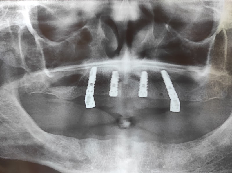 ATCDNfWAVBklNAgPBGF6Afm0Fl4fqQf3EOkA8MeZF9T7FfeeYolTsym-vB9Uv7lz9TgXMVuoWsAa6nJergpZak7maU-9HxyvbSH5WpYqpQKgqswPoCVQu0oxUdAJ6EfXKiQZZ0FoVU1VvRmJjZmwcLTKIStWY0jXJw1c2L5MDE_x0GTAHvLwleI4fjG0Pm70t6MLc0bpiPGhKDZhDm2MDyWJnDa35g0ZBPuNnvkE_HUsHa6l8Twm67sH6Jfye8iXvi6QlCxZiAsrf_Pq4Ui22khFmutBxTUIzNAc2y0_tXmoc07CIg_3