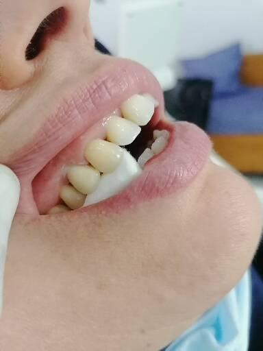 ATCDNfXfSVh9BRjPYfHFt2c66hyZf1y37ZVXlviLxcbOHHDGI8mYrz1aig8qUY-c0n0hGj2e-ijuUK9DiSctx1479irYrHHpfnCW5vRqGUXTev1mZNEm8ncxDSk5aEExvJwk_N0E2iVT8f4Y-zHjOEU9zHAIIlBEuCDNLrX2_L_c7_yBLM_J6ro4HxxdyPfpG1nUgqvLHyyYyNSJPZXrjZjM88iC2vau98sRTpIPJhOwJ8CMoSSFNVMU7VW8B_Zwy6SUQNk3Uu0ck32dvi-6pTG0tB-NVGo5_GeDzyGd9Kx2-q6y2A_3