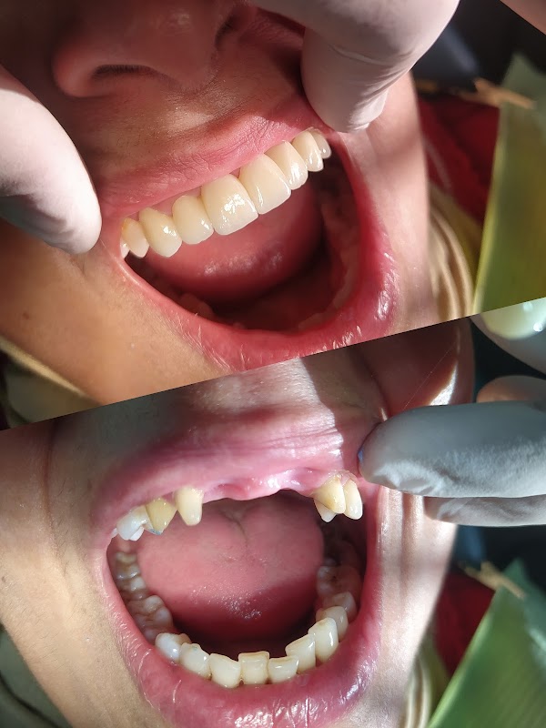 ATCDNfWE9d2lwBKrx8ocTBeR2x-RXKwUlekYloULvffXDbOmNscZaAct5nH1v-qaFms1iqRJFQQMSdtZ78OfwlgHCH7WCu6KjT2Njw_Qjii9tLLSlhQlj6I-sikrZtXwaVo-hbBxAKn3XxId1X_yzh72hzpKG0X6XIawG-wq6UAcwK0Xt9h9si22XqzlU3hQdpkEG7BbavMPlSh8FeS7Av6_6lGhDeJdd-rcakTxlO8Lb7MLc7WG1Ng9C7pxzIMcrD_nMEsIhR2Qgcg5R1xaX71tI_xUfZUr6S4Af0gf7iqPPZaBBw_4