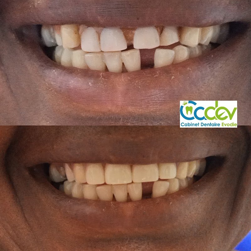 ATCDNfWUd7nKPmyhmFPYIHu5oSjhh4ezvJPUX99VOlJq8EXQNbRFCQTA0rXcMoOBV-J2If5CTuqTMgFmdCUXoMHz8u3FkcahuicxVtMZezNJzXCQSSe2fX1BSILR6QzIOtYtMSGZFouj15ul4RuLJixrLhbdLn9Aw-54DT-aa9NRvsBYXprClDcO1SXWTDfAXjaPbKitqgZmJAIY2oAflNMPubfh95l-1oABHIl7MmWTA3yOtKsPHm2RNtaa9RBUdKGRvYevxieBWVkezvcFH3hQuPblgstAvLXDKowR_WNd_HjEvA_3