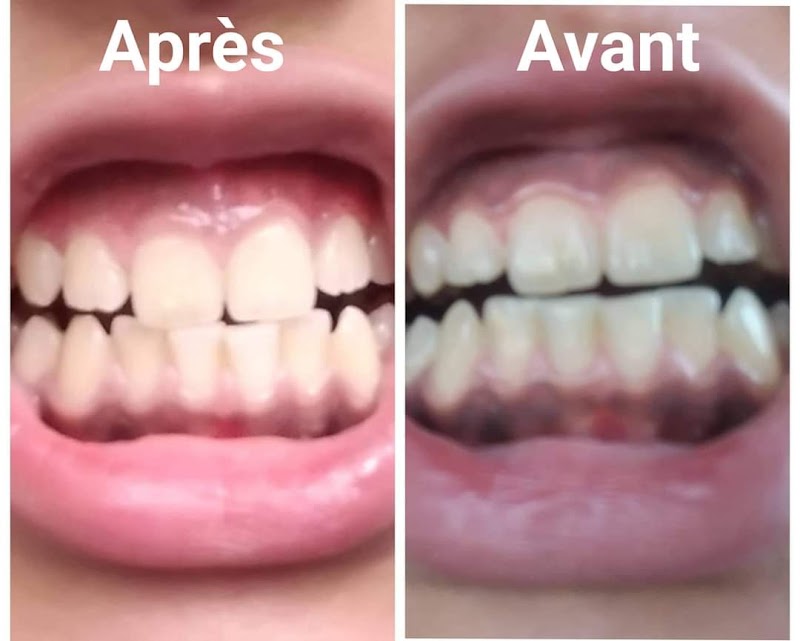 ATCDNfUR3Bekem3qaw5mi8jn-VpDtG2CTf18yaMgoJwTFmJ4snFZsaMkzzaXtGcqxX8UGtXCFs6xYnVsH9r-XvtEH0FsLpoMaBPkdk4pEI2zR4r_6b_JPGseHAEUfX1B6WCfji9WobfWz1hyvmSvNx0VYt4s-ocfjiNPdtL_LPbc14gfozIceMKTO4x8Wzu4pTAu01v9Kx0uZkj-guxGXn7f7w58IlPkSD-178uvQkTkeMb8wAXotoUP-WclMbsU50eCRvK8RRLY_5uEsce1soxSNa_lQlE9GUmKBAwNr9bxmE_9hA_4