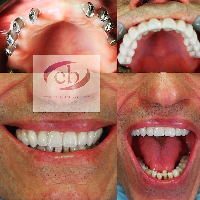 ATCDNfUSsQjyPguISQoW1wNYOvCdxmpAl2uMy-X44A9RREmeTkrqflkgQM_aVQYcaBOURGl_P_scuuGq1JeNznfVIagwmZ5S_dSDodDXmX8mV89n04I0LicaUa33TOuXFZz-KViV0a1Ohyx_QXJ0zjrimlwg8aAv30GioZO8fyEWSt-cB6EbRKWtmdzW7N1I21JSEYiZwgz2tH-whgwn6X7MUidUBPl-JSzbcIM_z-7jDw3TQSfTH1NoP6gMG8Mt_mhwLO48YNuT_BWa0evXtqgNCd13IvWkJ6eC-5f_stJ9C4biQA_1