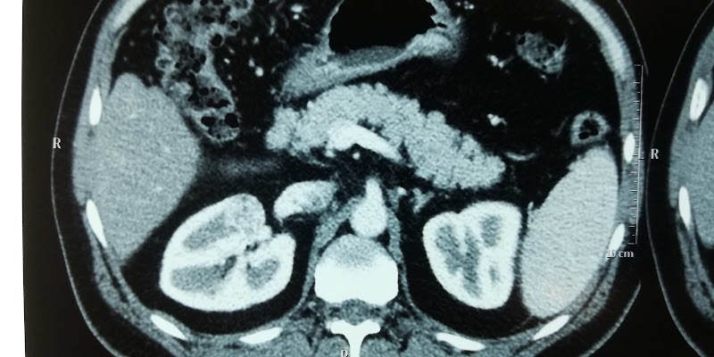 ATCDNfWOHQAv2Nrokac8xP51zlFrvOxeiNNqvATjJcKZ9WR2rI3Em6PHS4OY_z8hYaPE0JVCayewNaQYtuxvwnfbLG0pddwYeloCfF4WFARsaeplweHZx1yXi9Kd0YF3b8itRAoG6ZiIfRSNlLPvhxE-msm-_S-VMuZM2j4JhKppWD4439GwVjRmMviAFWkwYCITxvfacZ7AXO7INXtxfPJwPbhV3zK8hROonmKzeyJTWrYjaPz2jq6Mcs8jj_tX6z6fxTaA0J7-6UYS3gvzPDGi83BImCTEzX_6na7Q5GoAsLSF9w_4