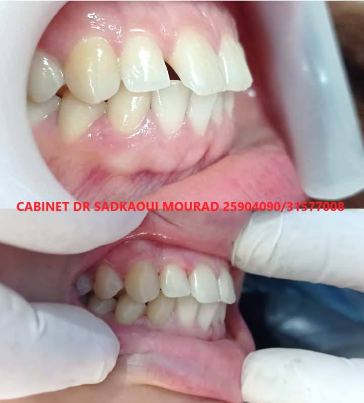 AU_ZVEEvsOb5MKZ-J5folF202gBs-cSkX61jwZbD53Q3mosly5tDjWgfO6AaMnHcyvOn80sgx5-7RfQdzidkeXK59_5Ll60J01TgvJ_NrnWaqpg-ogDDW2Il_a3nc658NhrgQhCLVyjWTWNImJCVmv9WlpeoGZ0LWnCpTRCFuFXJ0HQyH2jKm3ONndCreYS5PApAxqW3jt__4Vk4CCOHzVVac2qoEcJ8ztIELAAtg9jjOYnx6ASIi9xmQmbtUZZU0J6TgoX5pqYUCEIkR8wVFEISccS6jrrmqXmmg1zu-pXyePgJng_3