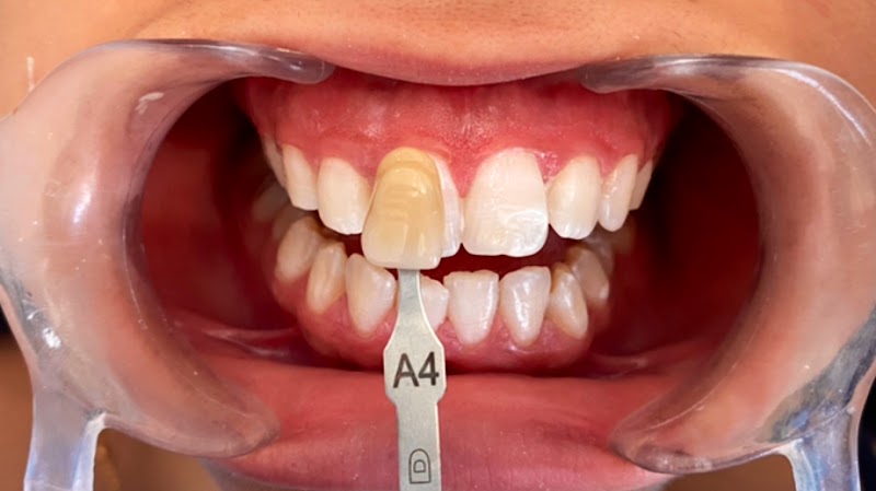 Ab43m-tsctjkqZIU2zGiEPSA8zZpoWEOC1iWgqOOPM6BWobV0mjU5i0OOHEix0OIHl2IHGdxljIc-jzmba2ooMgCSL2BY2OlE2BU9p0PD2mXn6fbgvDXWOtl04D6EE2W0B-OKmAW-FlXvgRQ2BGF1EhDC3kK8yj8l4PTlKDTza-beuiHNbaHS3mwfEkgA_8jFAuhF4JJpMobbXPQHkG1wGS-ADKYysmiie4nmCiMTH9AAv92a_oPAs1aIrYJC5mafjCeGHGgT8EVgu7ScsreUZY1O_KU-eMpqPpCU_nekibBUbbU55u_p344GXX1erj3gRPKywSMq6sY7g4p_J6woJAzbFpAHtBLWu_7J_iYfNcDkOZcw7erFNLP-13hXrQFyIMCkNJKB5gMxQOCPbmesNumg0p9lhPS94gSFRkPmZfKcH7Gslw_1