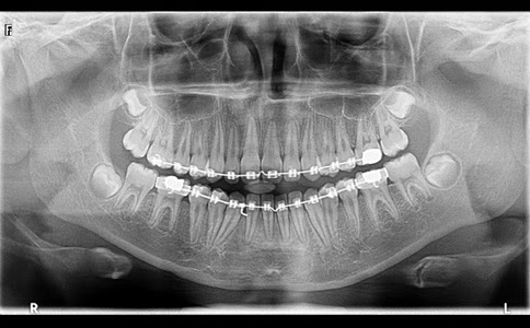 Ab43m-tGTDbS4lJhFwUoDe8H5RFcO9JgCf23VkpNIH_acLdoPBALDM_y3xGBKNSpc840PW5XLLtz9VQQeWt7uLZtL2RiniAJjW5QMjZeaO7QN_UPtawI900ic5tU4NGRaMbyrwiVedsterb7ELOEQo8a4AywUfOO3oIpE7w1SqLqtg9P-exFC4GxsU440Twu31fIx-bKF92A7A_a7Rd4HjtI6H6MMdbxz0x8lkLQrk9odDzl_j9fHfgQI_hNlRrp6QjP7-jj-BTTAi47hnLagX75WkjmdhiI1t8jeyv1jkGK32RyYhOBs1NuBMlf4ZXX76jCJmXlPcPtlPhX8gfdBXfwJrH2aJXuVVMl3HJ_DXIiMEO-P6-72Pz_eGJwWiqpr4sJ3tgoOkPP5FIWex5TDnc3HMtG7uP7J84sRzEsB9aQUwxs0sOM_3