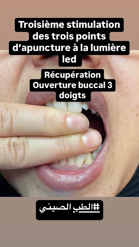 ATCDNfWXrh3xfmbdHo1BSifF9m_dWZOy_y9hT5eM5MyjqdSbsoaDVDiaR_UM_-b_ga7qALq32IQTURSCUCRgbmh8zYkvYyNSuBQtV_R8818yAXjAZdt34Z4JkoJLHWzDAufwZcPQSBfluiztYWG-8FFoE6ouAanuFbiQLGt-dnIfzNUemqgyxMEfHniGiSvVRNN3MVkmqMPzGU3i0rLrItgzeEUorOJ9iJEFGIaGC6ypezNl_UbtNASbzbvuAtlPvFZom8yUGVbkNrKU4CRYUskmNLdhsWdocyFpMQvY0BLbaAfynw_1