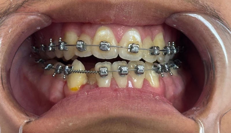 ATCDNfWqkybB3-LpHPYYgslvZ_ZOeA8kZPNJIcjoR9WKl6sO3ZMwpo4uwB1KB_CKe7NmTK_hraKeRStfkFyrKJW3tf7tS1ymAlWaZRtRPEA7K-tmczsczFZiD-wANGhf_21rX5JVqKkxzapRtJnmQC4x002HSgiQG8nO7oEqZt6IgvdhnFzcLKzFyMmjxZgkhmpBTfF2jrJzbeFViHXAIys0SidD4UFX4Vjp6yCKAiciZVLn9kdepGLnhGqIflueE0pBWhvDTPaLqljT1iL0_1NQDZS5Ghv0pIvn7HtUE6yvHJVhouxIoYikRLOruFRhdQu0J9D1BWm2ZPH936eFiVy5zPsg_-nwn488jt2Fs24Rh-N2E9oiN_Rd7VsN8lnV45s6hIpjSSyGrkGI0ixBi4b-QH4ft0lsoFH0lpTYunpVBd-aL17G_1