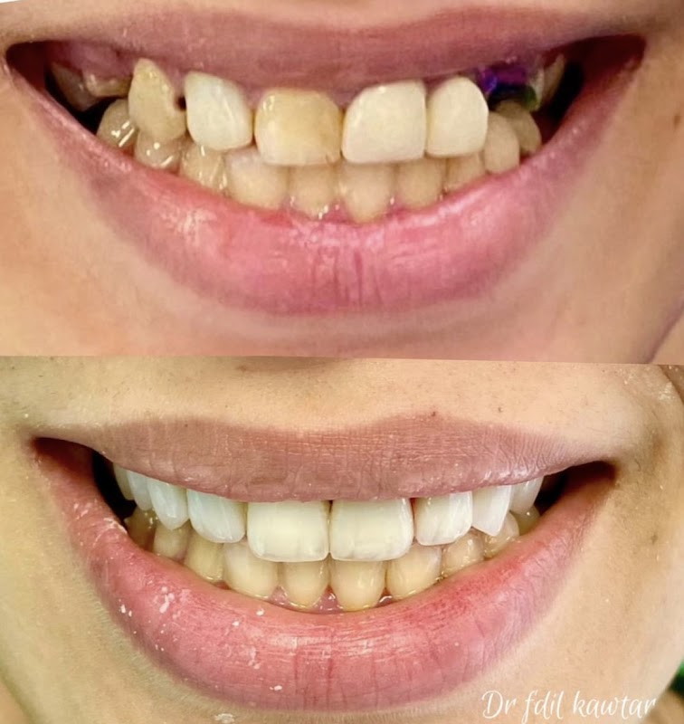 ATCDNfW4CY1cAkB2nTKBR70LPTo0PzTpw5R4gUue1WSpinfMenUD1MAup8M7IHZ9VApGkrY9CW8QdpLgIrcAVpDcfM2lvNvXlXQ20jYXkP-3kgG8Xujneb_ZZJys7-DJgtoPMywwH-wQS0xUXrSq78hi-BfwTcXRutVIHhTYlYGCrEc50sUP6FuTY7OQUvbQblG75m2YVLi3rHCv47M59XcngCY1UF5_5BKnx5YO-ePpQ1AQU2xn18dCzso1VVUiaj8CBVkvg6aUqDCF4JIrjUBX-ErbrRnNsS3kwOsvgL82EWwWVA_2