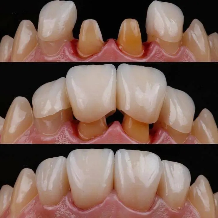 AZLasHrbtOePsmF9yL3GOflXXmTe9YR72teoCo6w2Iu2MF_aL-XAHbiThSdQ1ocBolIAexEPh2fooD3lQCMrNODUcFq37r-j7p1MjytkkbQQEQGOYjaa9wI0iSMndfJ2BB8EszxqvAe7SmNPwwySjQ8wnSUiqhQP9LV2uho45CwMFBoKOQqhut7BG5AhpHtYxLphdMt59LoBVG3Pqg2W6bn-TpWyHPwfsMovFs437-Gv6YBS1paPHWNKW--hYUztV5JKwFUnOLqTxeb5WymusRMQqD8Wdyo6qi_vPsSFnACCGPzA8A_1