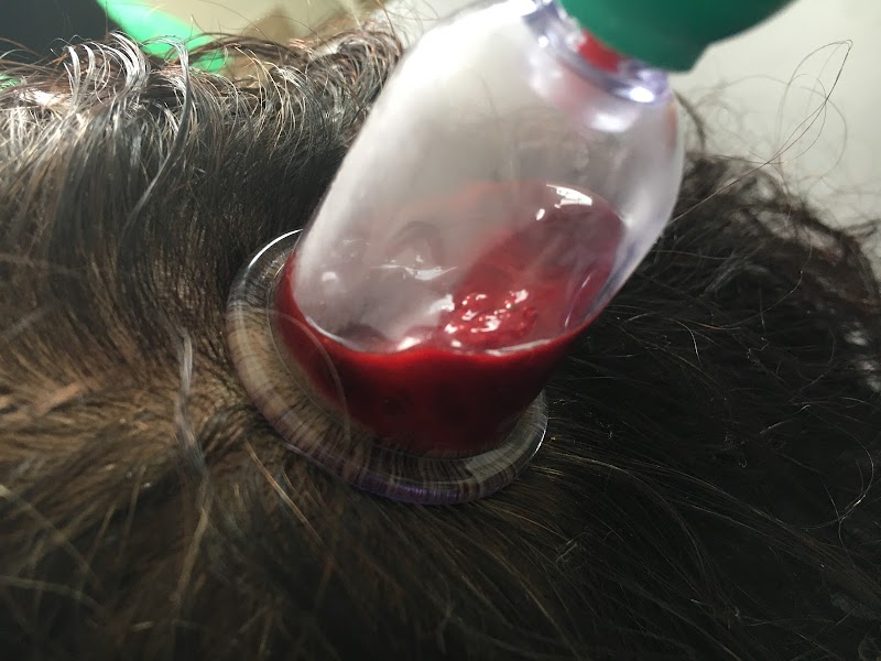 ATCDNfWKbV0QcMqgIxbxwkmCey8xeUzT6FARorByDKD6doS7s0KsEr_Vr1Tqf3bBRcJcucBTAwDLQ8zI_9Q4iJPrNSGj1Brk-oaAddCaOW7IdujM0wP-Nju6W1sI-F_3NTlPCmExTj5xN-AlEp2GPQtYxgzQwTHeTyeJrbXIpDQOQhpIX78TGd2nG0fMOcnFaXGv3I-pMyQk69CZKClmTHWb3BPW2-svf_cPvewszFfFB0l1dGsW-cz9yIsAWzOv0ItpgrAqfg1gZKZzWAOuhGmdAaAQUS0tgGYDKbpOBiAxpNaibA_4