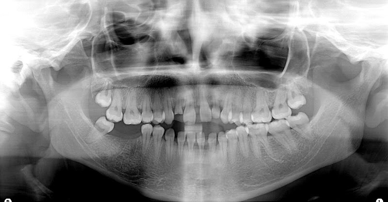 ATCDNfXWPFrhejCtPS6tGy1_q4_6dojDGTPiJrEkAr-gT1wEzXeZyx8fyf4yLgXyXIBHc9UgO4PJyrDOuNQA2VfIJKBucsbolwTAFT_uJKFWAdsd9Hoe27UJntMfRCTXBfrIxZnGChiFvMgPpT190yqcO_14tuIXJtWGk0XLE2Ap-wMqr6yBU5zUZ-AxtZs2BkmtNefi6XBCA8v1hMrPSNhgiBWdUi4X3maHaAZft8UdgETOe-wFEObNcQ5lqKJTVtXDIOPx9V2A5J_vbnGTDf1X1LYcP4lRFUgdxQlQbQz2X-JQww_1