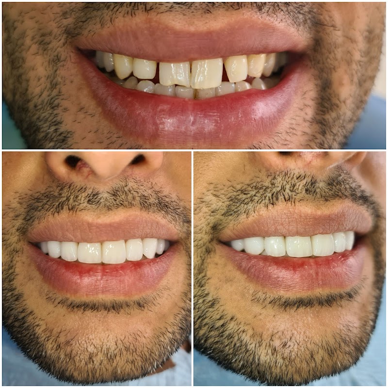 AZLasHqChNhoW__Djb6lANQlwHb4Iqx6dsqhI4Dosfw1d7SZ9HDSC4TUisi4JcXZshNVrnJSG0DCAyeYUc9aTuE_TLZm8nlOwlKzR_8q0ecIG_tfQDT85hWYJwoCQg5C0HlyVBT2rE_Hgvn_yanzv_T6nP7vonjfsdetNxr7cCtRQz0HaML2HQimdDANmvN0D2g-Uvv4AyUjQPIKW-y9xRTG13nkaeUNRlruv8qVP-ZNRI-I2gfJAP2UQHZHdu_VUWaNGCqXCYGq6dEJ8tkHkyIoqY_y87z3-SmqD55_wtOTPcgp3g_0