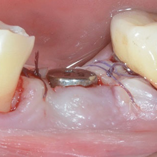 AZLasHrXDovNaOhvKjxGNhCv_LtVHqjGHO4gK_Iz90MJwRwkkGj15L2ZYyJf2hAiLToXNjHdvqTTP6T-lql5gw-COpJFbdY6kY7tnErjETnklbFdHYv3RzOf-rT4p7XKNv7gRtk7fMe32Q84OUe0655t890FmxYABFEAxyWSl0VURiNAl5Qv8YynnAwv2SSBjHzaaVYio-RDSxqY-Fk5GHzjEynXjT1KF50ARz7aQIIyDoexQskPM7grXWDzEmBTp-jA6XN2ubjKz-dPQz3DN6M705g4efVozlxgVmDSns3JUp-8Ug_3