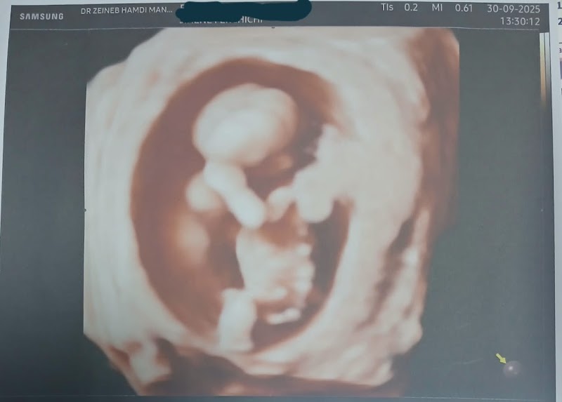 ATCDNfXLa8XDZX2__Dfp95jMOe45-C9AqMEbHWVbD9HX9vAkwoFZWRZ6RtZWaYU6OD7WAelTJ305wTj9D605tuscbN7WbGVP3w_kZp07ahE7I_vQd1gYcLNYJV1UXnHjFxHa4-wl97UtlIe0UaEGJrsR4FbnBN6G4Mn33u2LtsCoeuCQCm9alr3qcwFKqn0e31l_s-uP-Q9m_L1Bx70k0G1IMlFAuYNuzOWYeqDHhqKIb654cQ-mLetWdsWCF9HI1NlBIIp_6zjnVvYxHIuzwbV4wy1bhDCFca3o2ibr-w0KhUAzKw_4