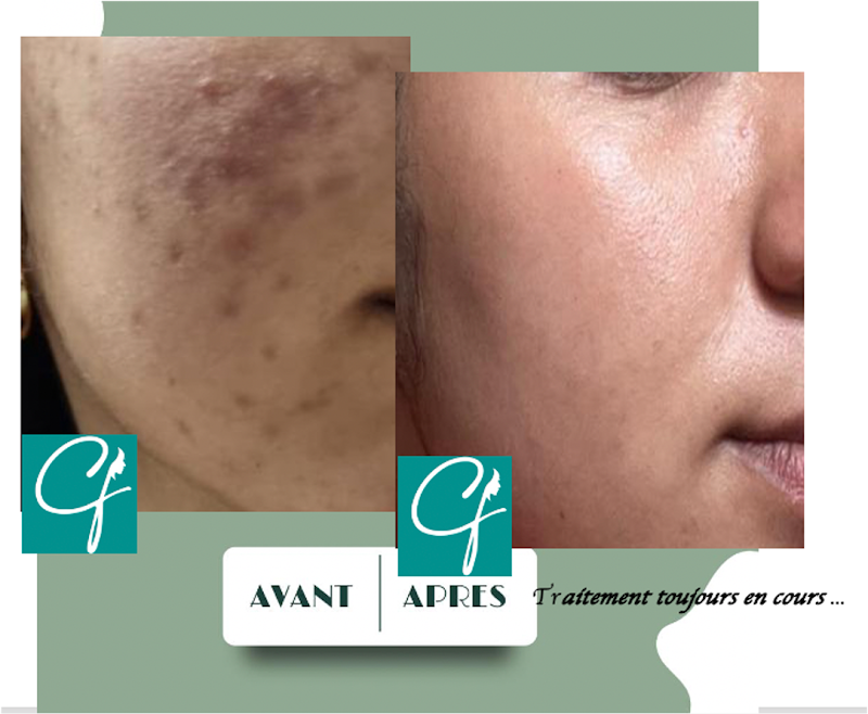 ATCDNfUrZ5axcQi88pdRlILdCBJFy5W_120aj4KmluSN-BYQ53j5fhvzq-jynsKtw9SwXaU5Nc_XXkzpZKPsqFZ-TKYs6YAiMqQ2FvYN4IO5FMgy0RFkyg11urUsugF_fATEwd6OLsnbdvQE__I2EHSyiktmYpN8roRDB1o-ELWKaL0Pi4vM2w9SNOwbxvLYAj16skcqfOBp8y5mWb9ccC38rbfkPcpWeuTBzeWzB-l4sAdbQMlFtAY49bsCfgOWTWx2IQM3DweQD21hoUUOHm1-wTcL-y6Lodb-oeK0UzTxzIXs0w_4