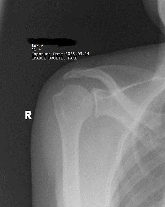 ATCDNfUBFsWKY8yL7un_7r-QkuIMOstOHCreiu6yTVF0o8lQdwxR74-tgzqvBi8ntpzT6-LST9CzzlsESJuhURFUrMhiI-zwGh1GZsj9jtp_jt04869DHlx6RKTUOJLaFaPxDkghldfpL-OU_zSBK-eyAaJQP5kNRq1Aaqz08MOppsJICmRMYCqC4Q82XPypVirAcnJ7eU_QggrG5cS5LVXJddgni14ImPKG5ovhc6t4HhnIKUp-MZVm6wohtvB0uJosf0cZ9hcMTJthAlofebWhp8a-8MfXa_P89mKa0mwJUPUITw_1