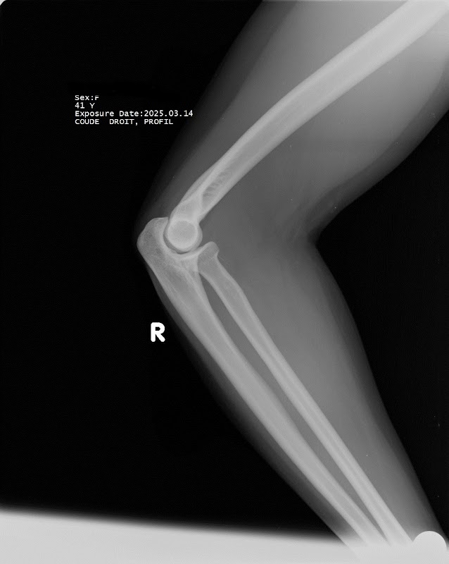 ATCDNfV5abLq9R6N8ySw_xRMCln354hjs1M_WSI4uUWmUSVj_jq0DeEzwlnpZGvJ9e2WqM6nT8DdgyQGmsTmjbLS25d8eztAjcLHVNMNVHcDirt9T0ZqWZ5HRzxYUjz7IyqeMvxuh9AKrmqQy9Yb0kdpHffbX5xkCfQV3TBRDLQfn-QH6IyYQ9BgmQU9Ut0zQNQhJXXnx9-5XQdCisAauZIw7eAjTcKfka5vnxdCtPdOaUqWv9UAUFfcRkne1kwk0Cv2VDtCaqBnjdUchkWEPbUDE3YMRFkobVBF7qY8D9bUeGxvRA_3