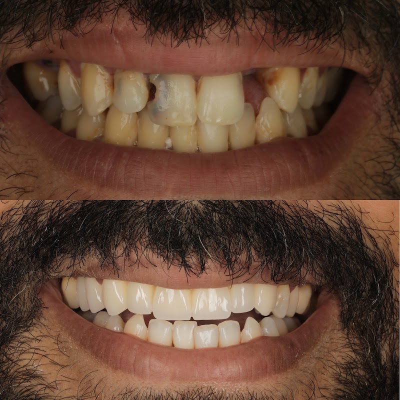 ATCDNfUkCsvYtiACfZp_aY1CJYEW33fbuAHgj65rCmsZhVIYJCbuVC2h7pQB1cxVbeB-0QOSAUlGU2BgVejmCkJcR2uaXI6_RL5o2Zx1mDsrq5tIdlWC9vAwmmQKxArh_x39hrCFbZRi65uPNgDEii3U7RNVxqHrU2H9SymXdBgOCwpwMhHno9brYXUDoqqc2jgF6Omay0bFle-TN7kd2yNbYFl8aOE1DuD5xBw32RvXU9juZ1SQ02xPxeUpekj0oOW3rVNYw52i2E-r6Mjia6visrHi4KxYwAEd7QtQYScP_rmjhQ_3