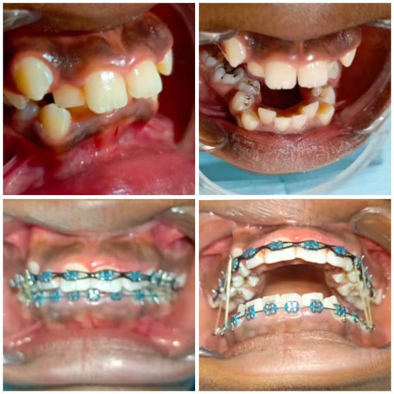 ATCDNfUOh36t5lhcy9vVxtW7GNMhVYyiBQUXRNn3o4T-B4ndMSqOHf-xxOu-TxCroHuSfsaZVtXv237COSAi5HOkypUEnjJdNkQgLy-zNk6JTQSIw9jq5PudJeIKfPZRA23MAZvBskteKlOkyg6uneKPTUVImP5lBLKZKWEHz9LOg16d_2Xbnn0Hsvy46wT9Cz-FHLeVtplaAN8XQjbE_kZD9SFT0fza6cX_arUlTDTueT8eEe_QNQ94NuML3I1GUohPv9FIK9moxzXYsHStKSovi3qKEaAP30HMdCGJww7XOSSnoA_4