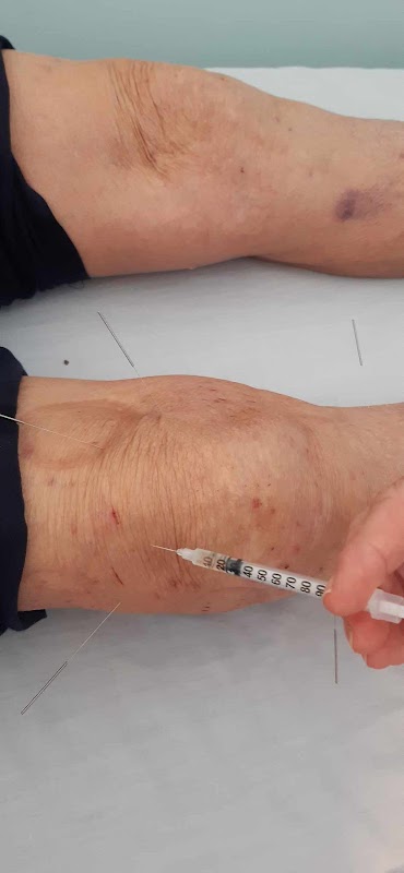 AU_ZVEFir1npttzcomiR73cf1-kwak1q21i9u8nHFXzau6twKKEscbUNFPbOC1IoIlHDR3TzmEOue65ObfZMdYNBP2rEVuXCqIqIxrezz6FsV4yRHLGSEV8ZMPAGOfygBzYGgV5H5GKYS6kPUBJrNEILsM6NERLkoOSFMqYYF-TbtPC8CbAiX81K-fTAYZ36kiipIxLhK997XEHyQTixLTg-Z0mhpEm5b4oew2TR4HVOjg8ZaZ7QkAKtkWhoZbak4LTWnoYyibrwrEjdG5FkXv8usM50274K8K5tHJphTBbVFpvA6A_1